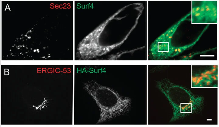 Surf4 (Erv29p) binds amino-terminal tripeptide motifs of soluble cargo proteins with different affinities, enabling prioritization of their exit from the endoplasmic reticulum